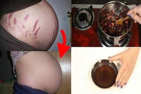 3 өдрийн дотор язралтыг арилгах арга
