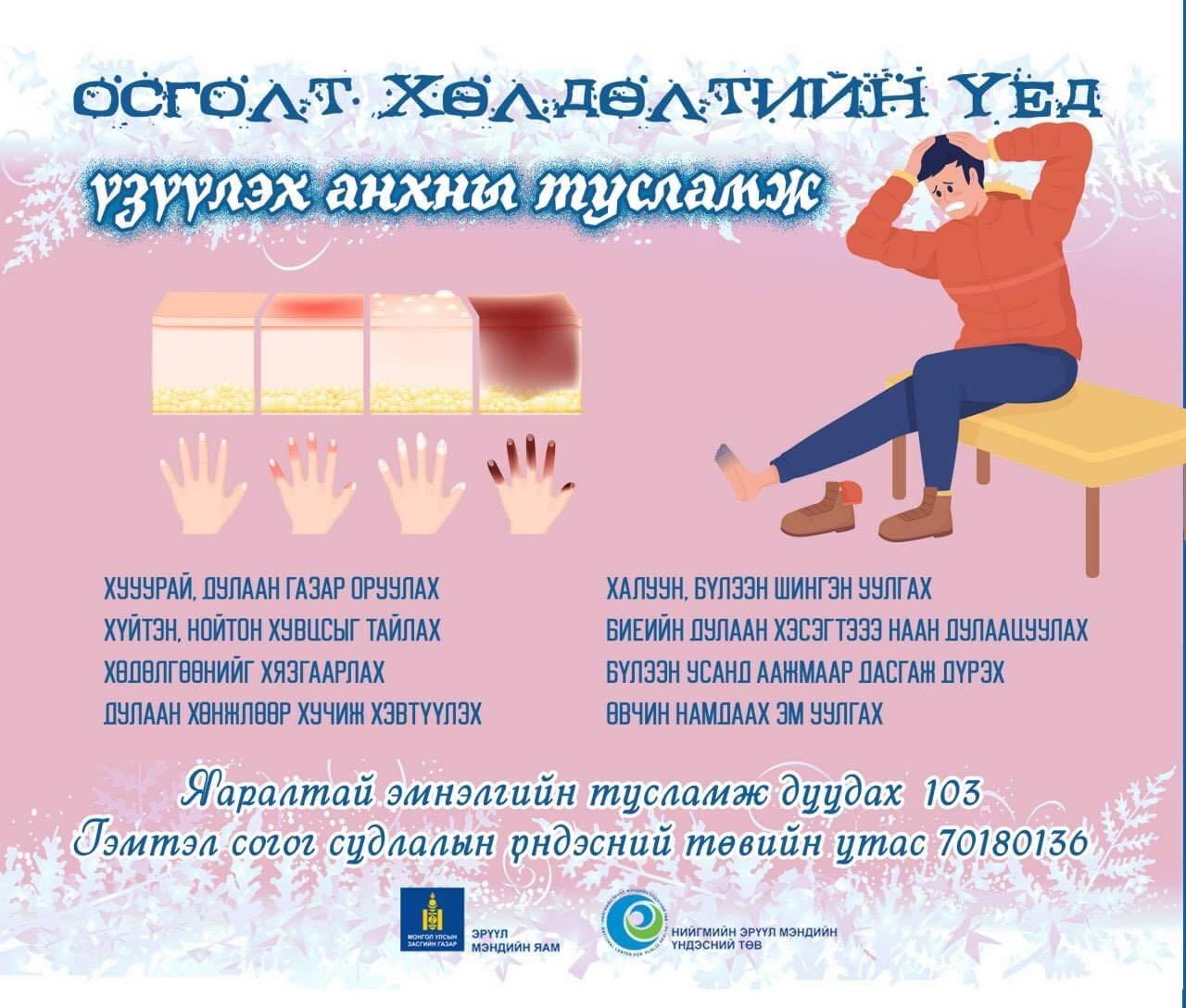 Осголт хөлдөлтийн үед үзүүлэх анхны тусламж