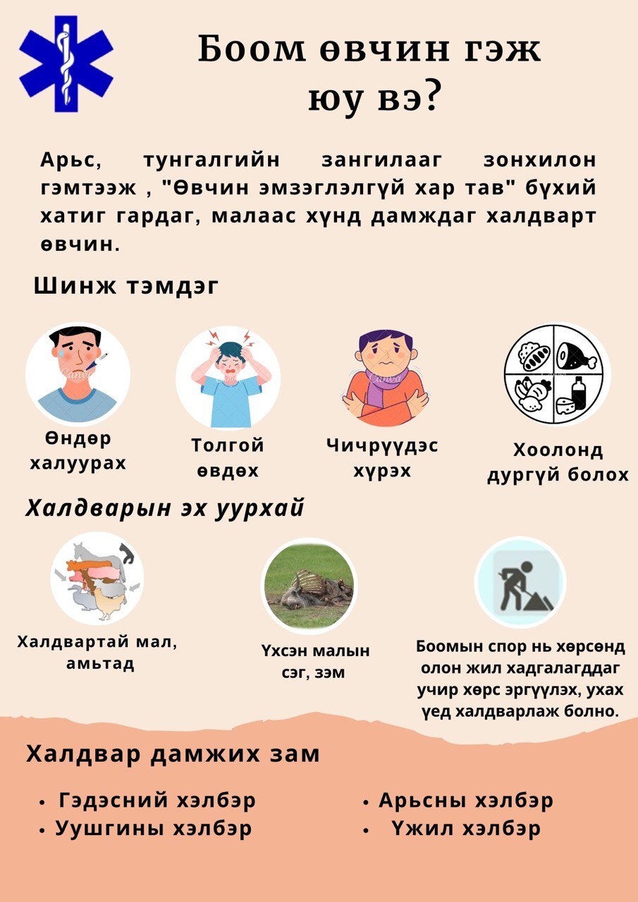 БООМ ӨВЧНӨӨС СЭРГИЙЛЬЕ!!!