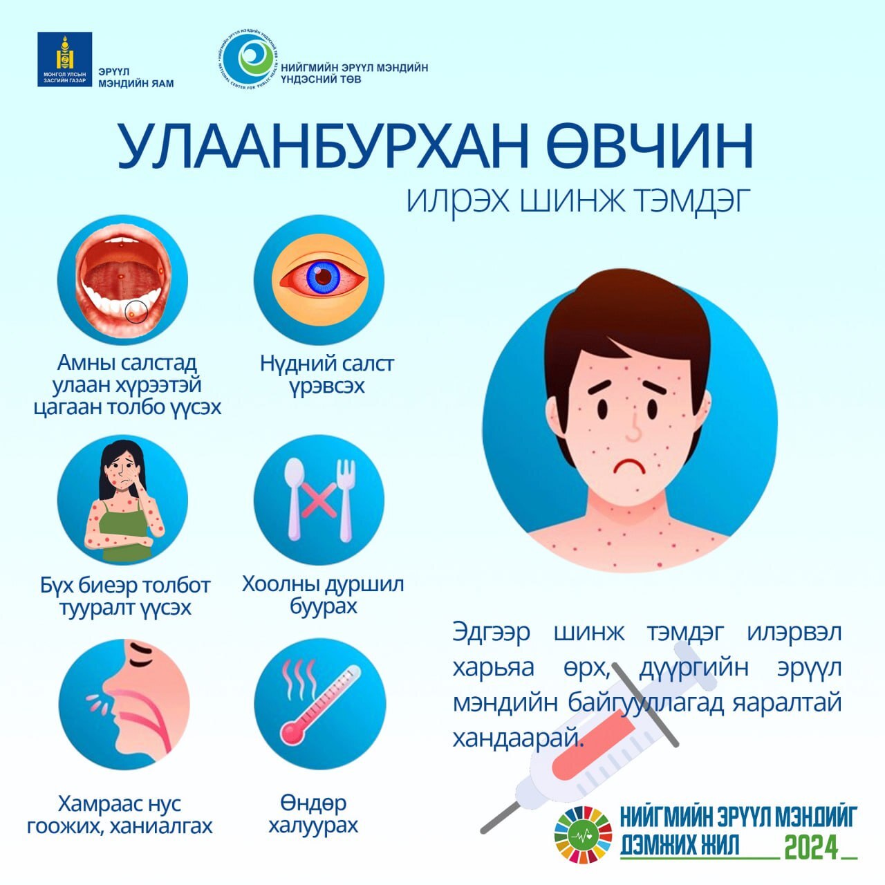 Танд улаанбурхан өвчний дараах шинж тэмдэг илэрвэл харьяа өрх, дүүргийн эрүүл мэндийн байгууллагад яаралтай хандаарай.