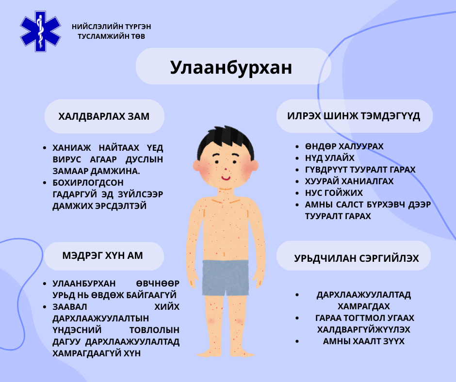 Улаанбурхан нь хүндрэх эрсдэлтэй тул ВАКЦИН хийлгэх нь хамгийн сайн урьдчилан сэргийлэх арга юм.
