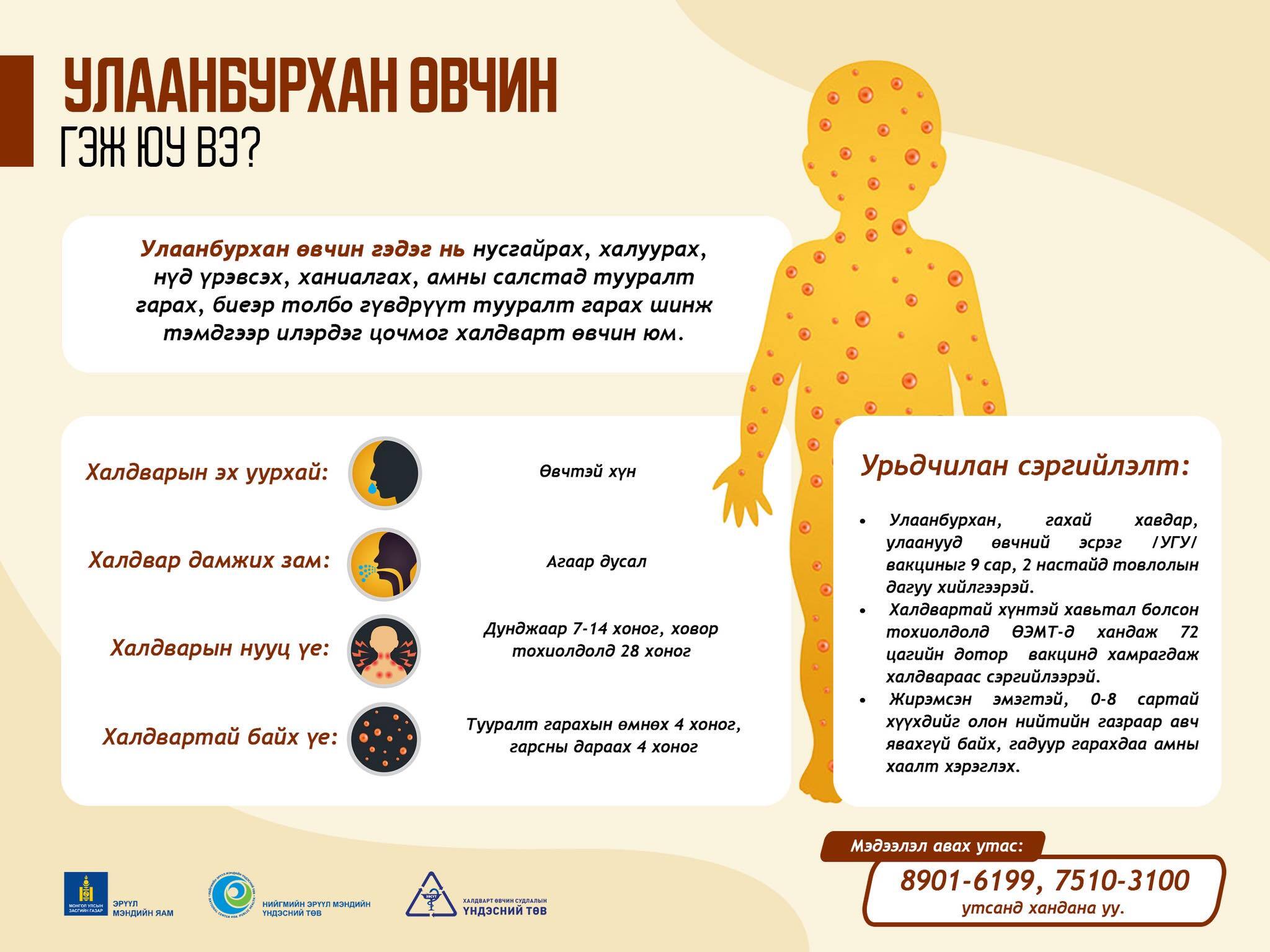 Улаанбурхан өвчин гэж юу вэ?