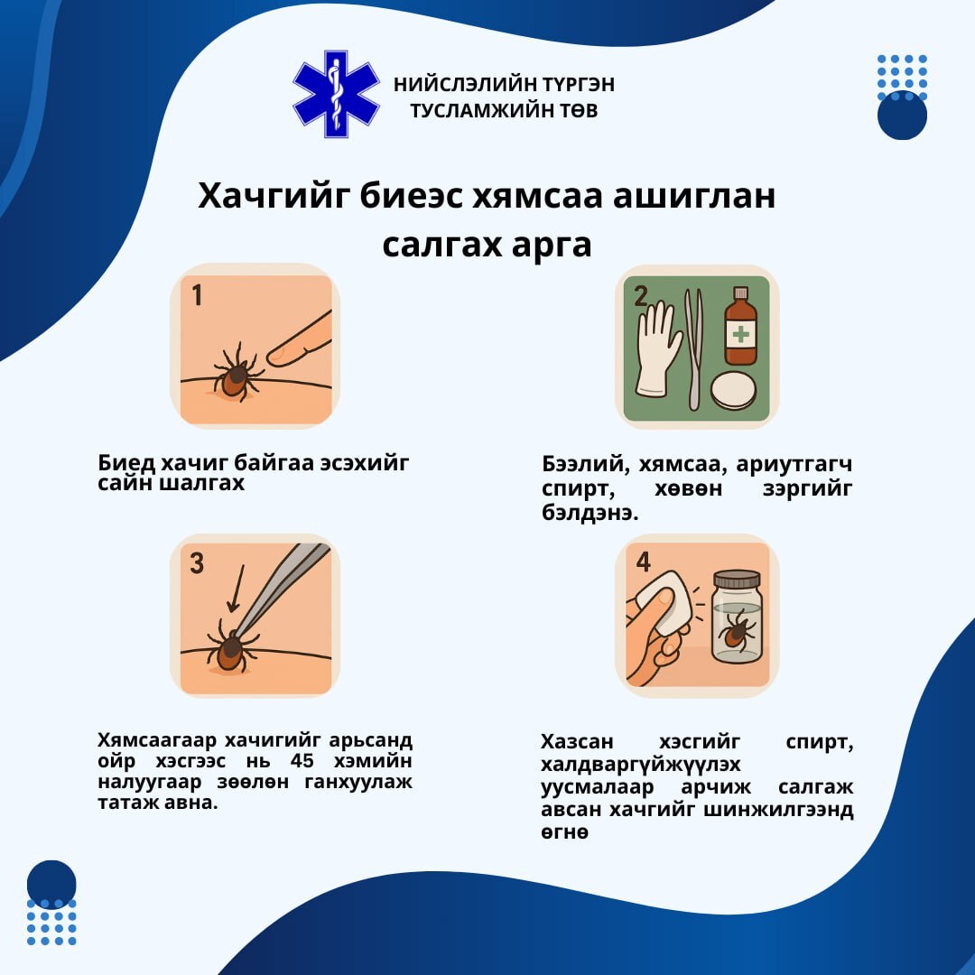 Хачигт хазуулсан тохиолдолд авах анхны арга хэмжээ