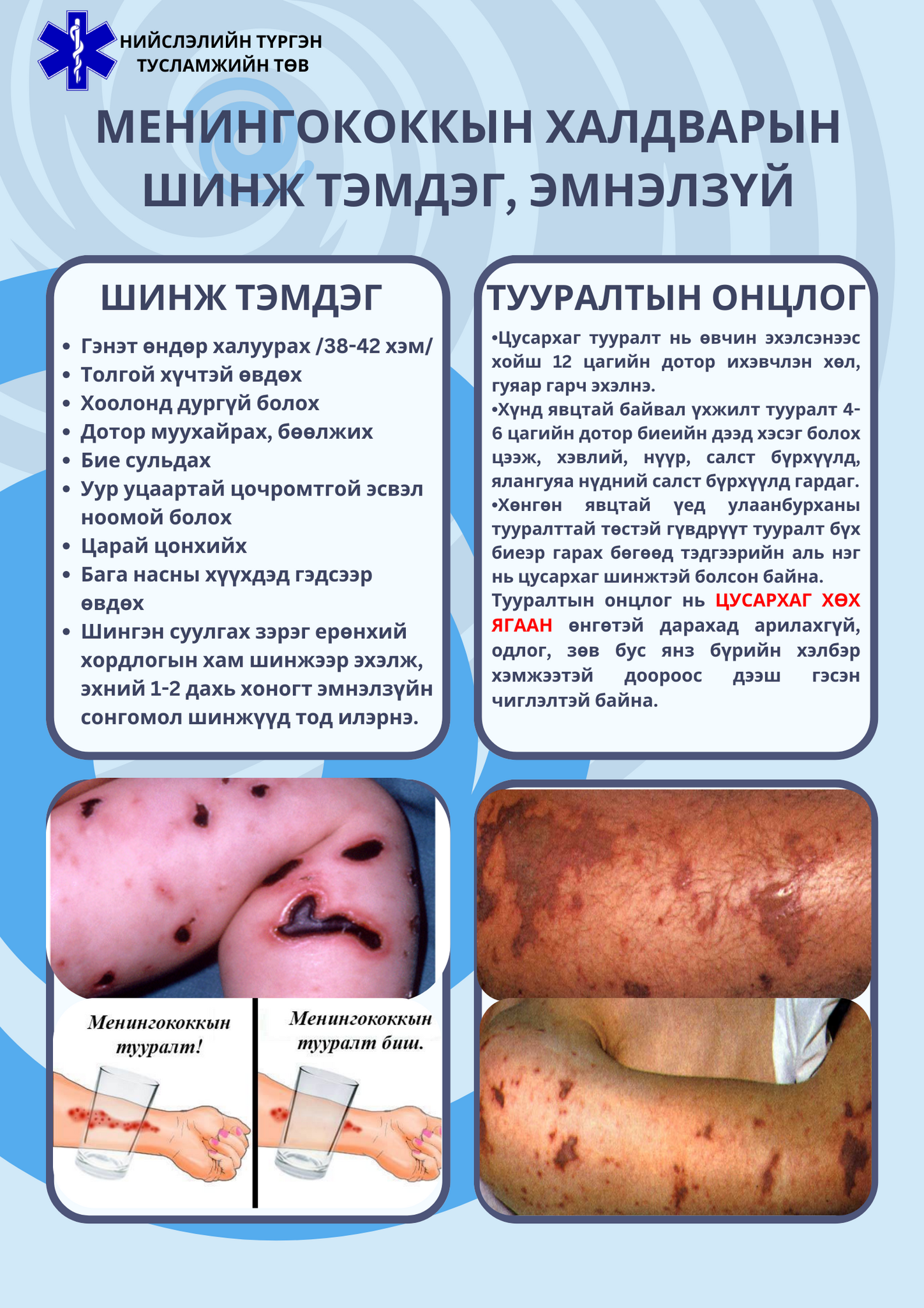 Менингококкын халдварын шинж тэмдэг, эмнэлзүй