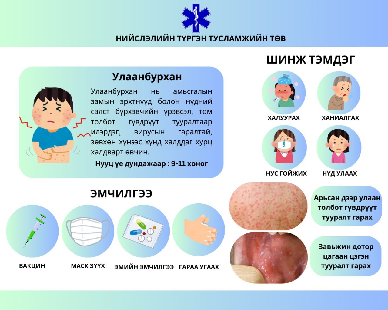 Улаанбурхан бол халдварлах чадвар маш өндөртэй өвчин.