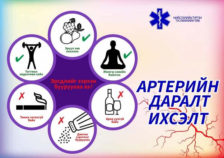 Артерийн даралт ихсэлт буюу артерийн гипертензи (АГ) гэж юу вэ?