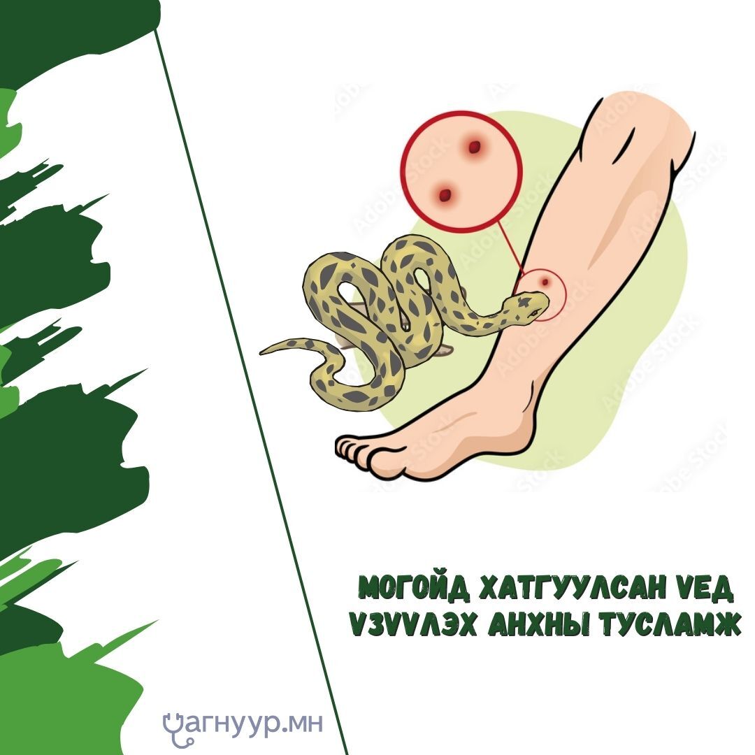 Могойд хатгуулсан үед үзүүлэх анхны тусламжийг мэдээд аваарай!