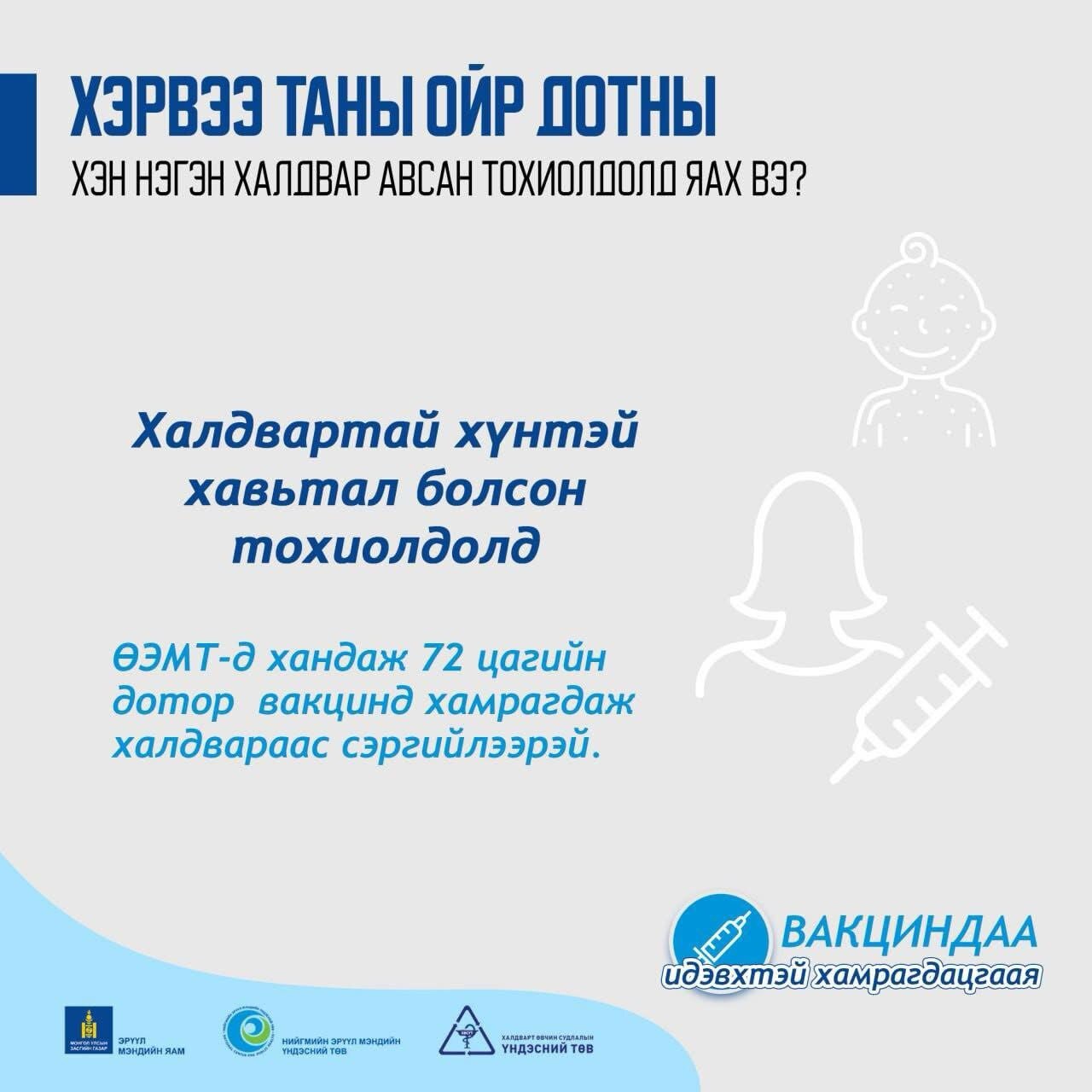Дархлаажуулалтандаа хамрагдаж улаанбурхан өвчний халдвараас сэргийлээрэй!