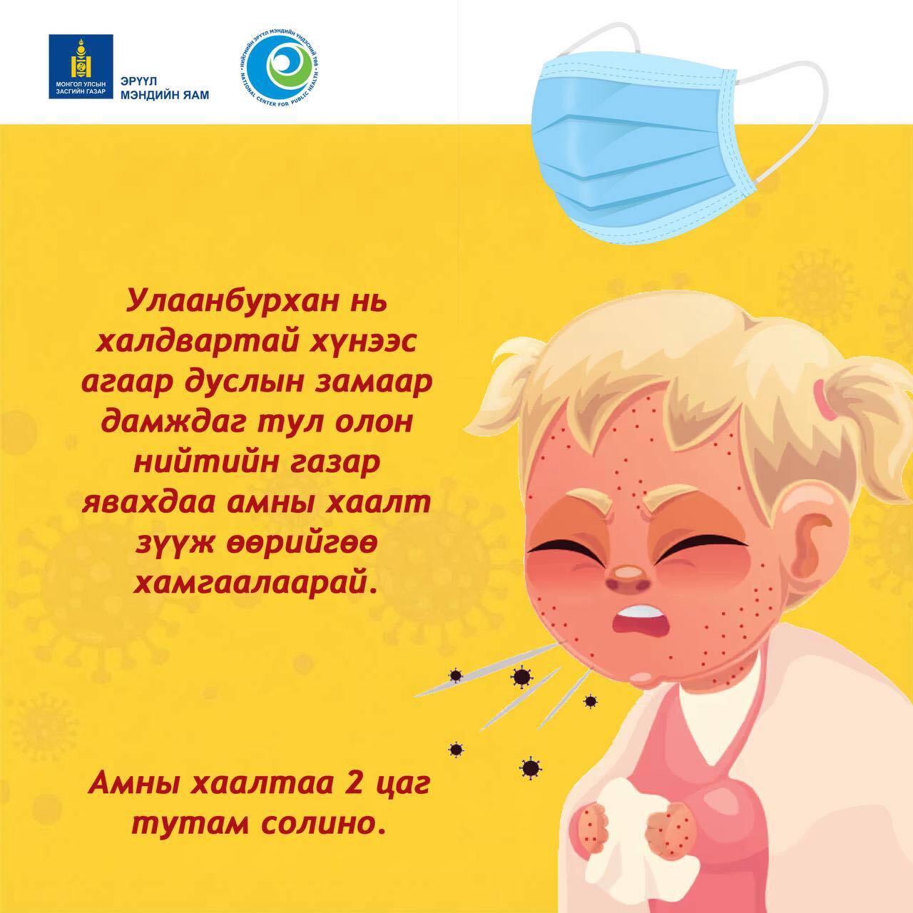Улаанбурхан нь халдвартай хүнээс агаар дуслын замаар дамждаг тул олон нийтийн газар явахдаа амны хаалт зүүж өөрийгөө болон бусдыг хамгаалаарай!