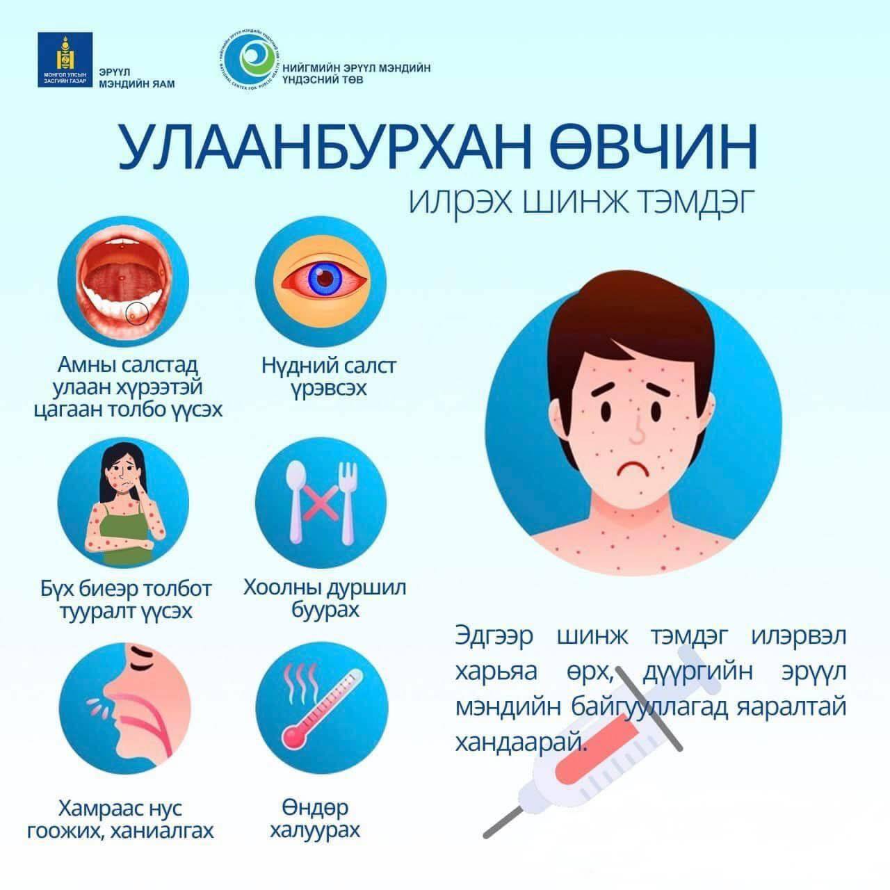 Дараах шинж тэмдэг илэрвэл харьяа өрх, дүүргийн эрүүл мэндийн байгууллагад яаралтай хандаарай!