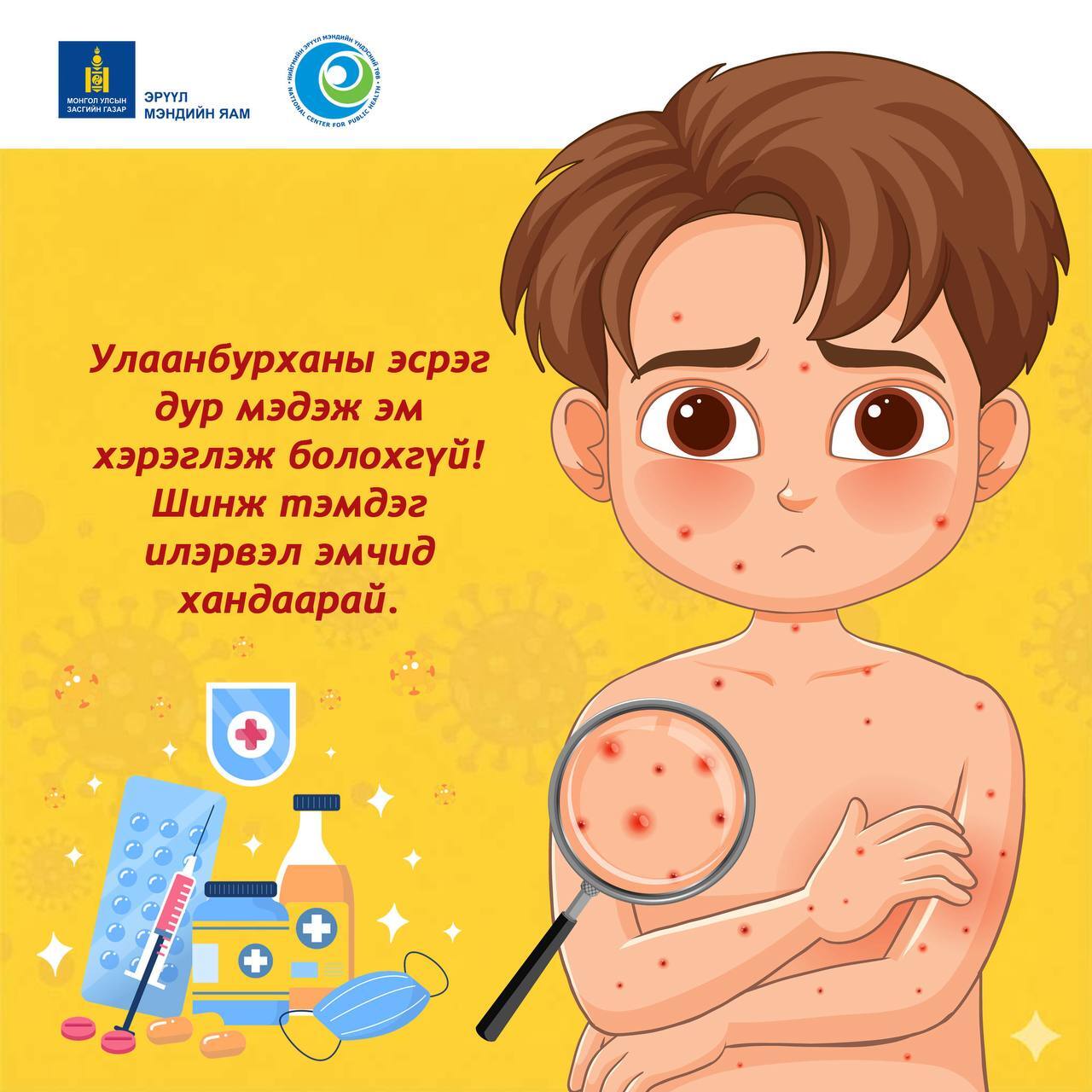 Улаанбурхан өвчний эсрэг дур мэдэж эм хэрэглэж болохгүй. Эмчид заавал үзүүлж, эмийг эмчийн заавраар уугаарай!