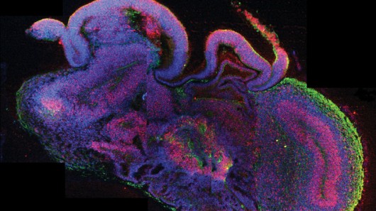 minibrains