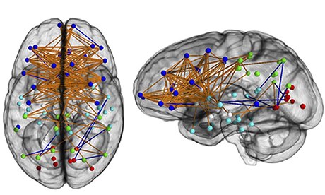 Female-brain-008
