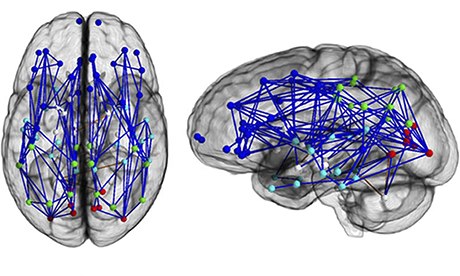 Men-women-brains-008