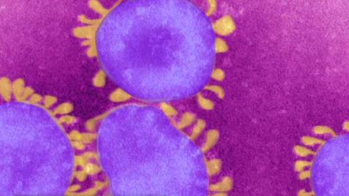 130218065351-exp-early-cohen-coronavirus-00001107-story-top 130218065351-exp-early-cohen-coronavirus-00001107-story-top