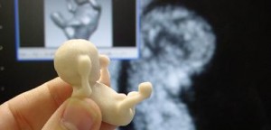 3Dmodelofthefoetus-_tj34 3Dmodelofthefoetus-_tj34