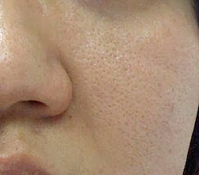 skin-pores1 skin-pores1