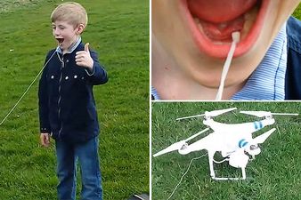 Extreme-teeth-pulling-3291239