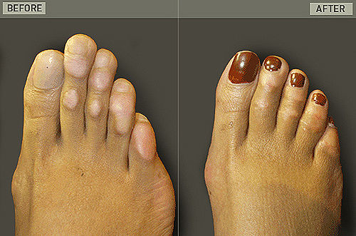 cinderella-surgery1