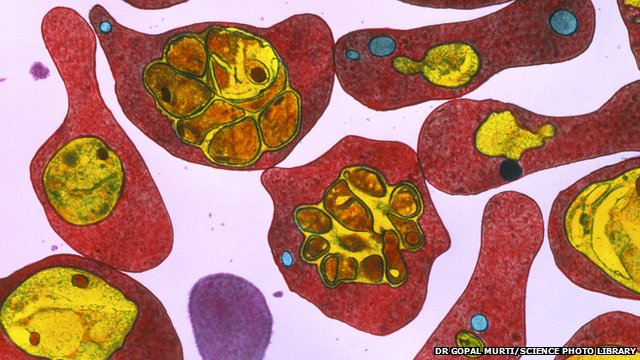_76631882_m2100156-tem_of_malaria-infected_red_blood_cells-spl(1)