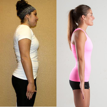 millie-before-after-side