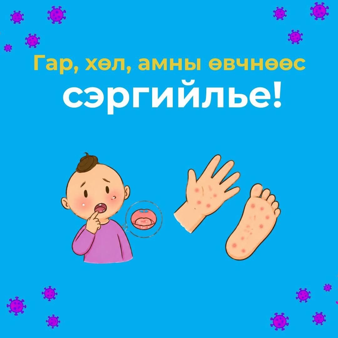 Гар, хөл, амны өвчнөөс сэргийлье