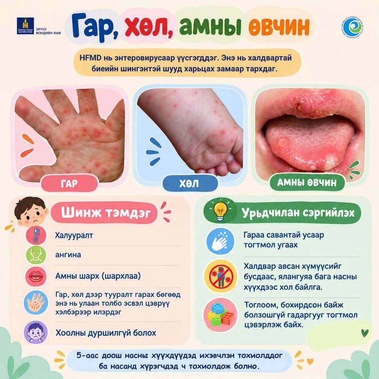 Гар, хөл, амны өвчнөөс сэргийлье!