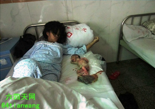 Aborted-Chinese-Baby