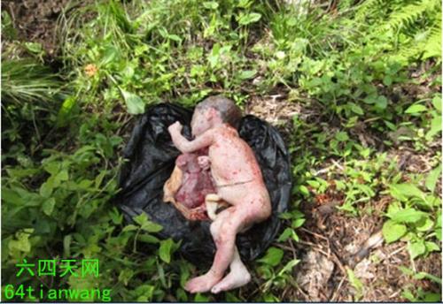 Aborted-Chinese-Baby