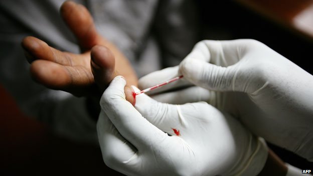 _71242520_kenwa_hivtest_afp624