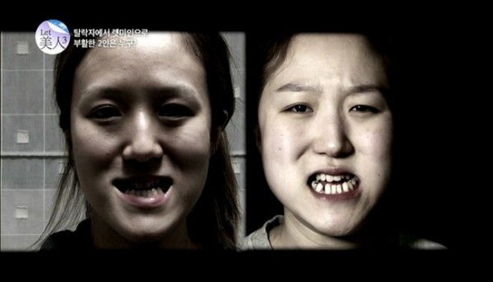 cosmetic-surgery2-550x315
