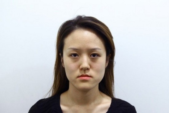 cosmetic-surgery7-550x369