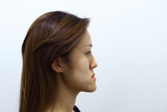 cosmetic-surgery5-550x369