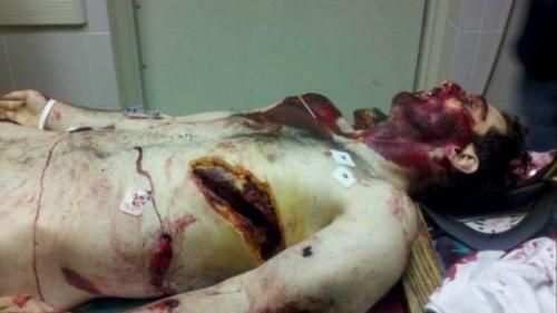 tamerlan-tsarnaev-dead1