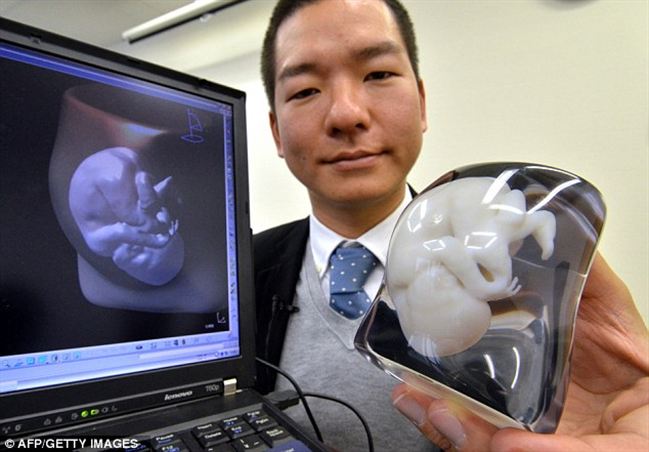 3Dmodelofthefoetus-_tj34