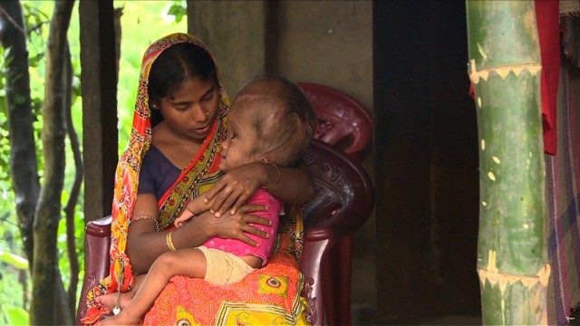 130815014849-india-swollen-baby-1-horizontal-gallery