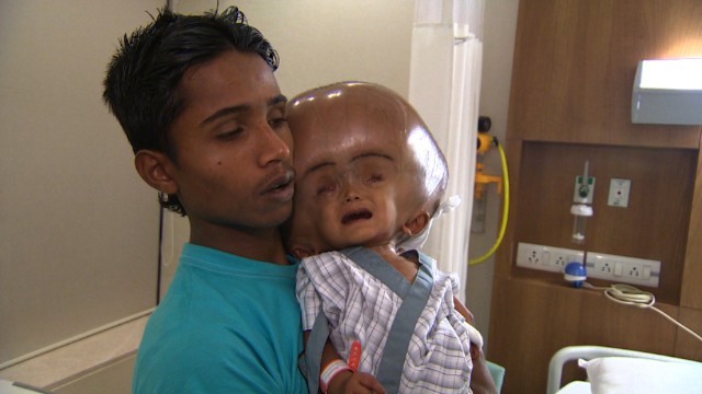 130815014849-india-swollen-baby-1-horizontal-gallery