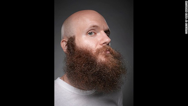 141007160406-beards-devin-cara-horizontal-gallery
