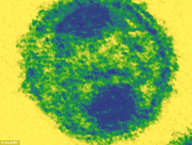 1415879667767_Image_galleryImage_HIV_AIDS_virus_as_seen_th