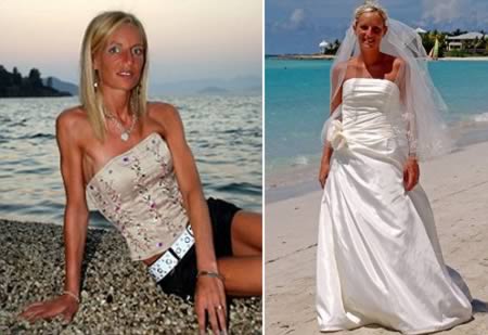 a97982_anorexia_9-bride