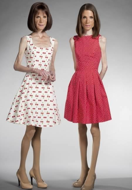 a97982_anorexia_1-twin2