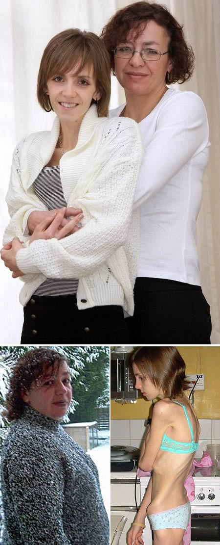 a97982_anorexia_5-mother-daughter