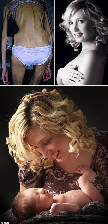 a97982_anorexia_8-mother