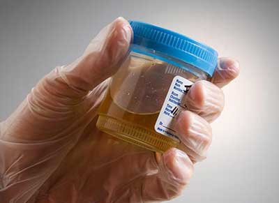 decrypt_urinalysis__1a decrypt_urinalysis__1a