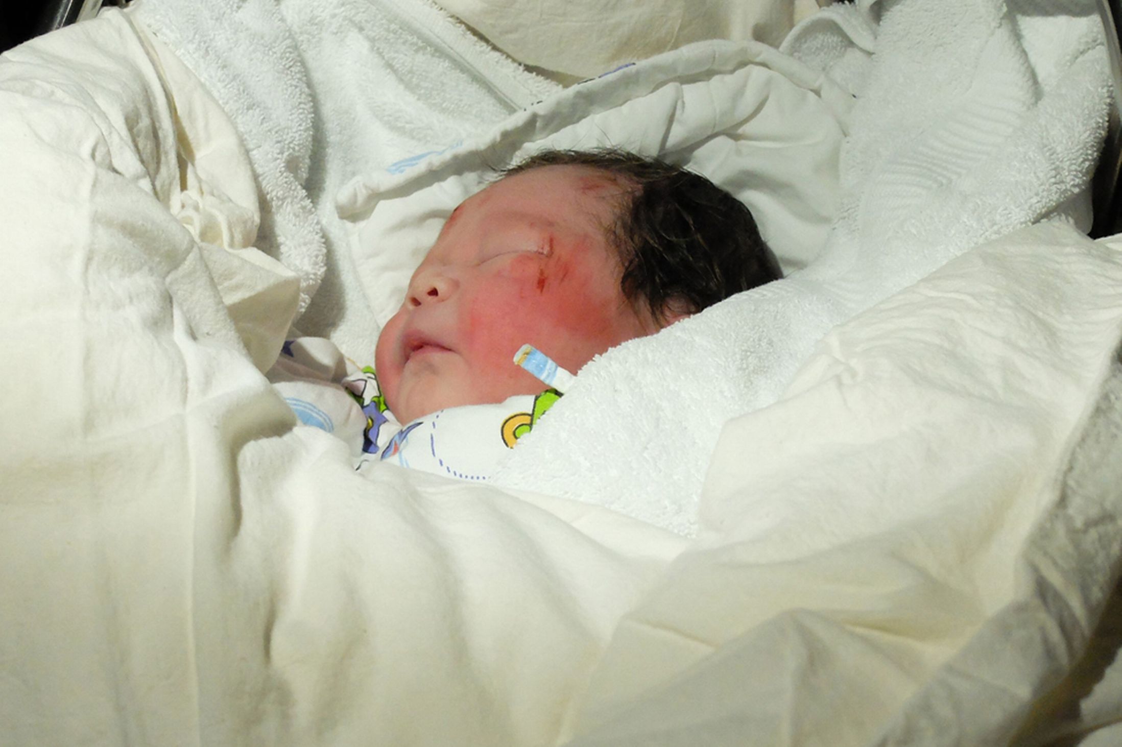 Accident-baby-3263284