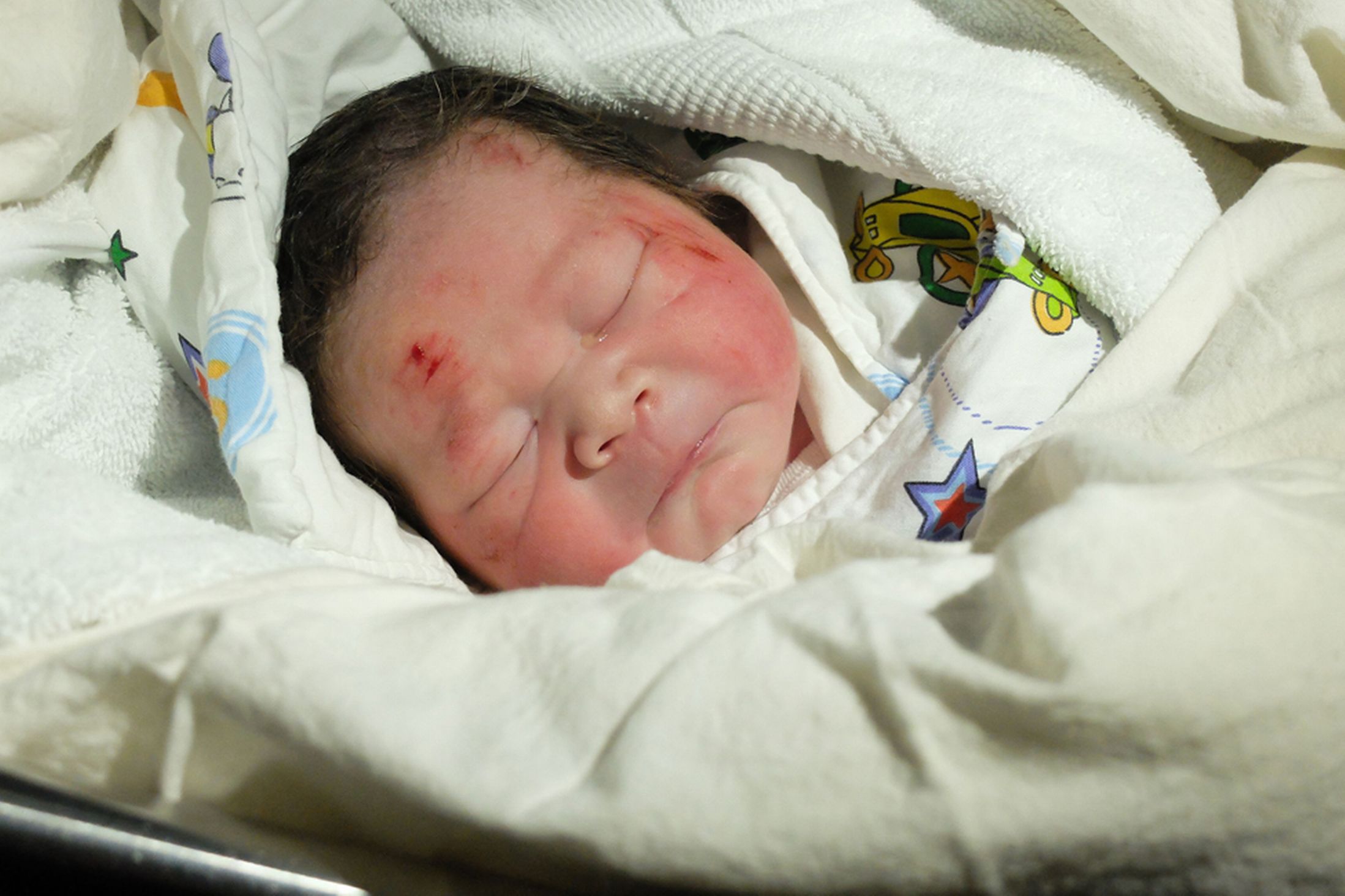 MAIN-Accident-baby-3263282