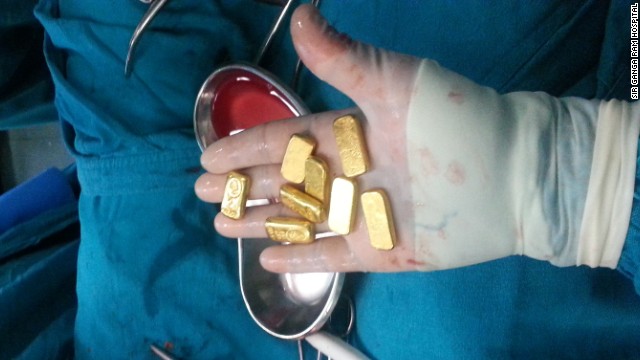 140422110917-india-gold-bars-stomach-horizontal-gallery