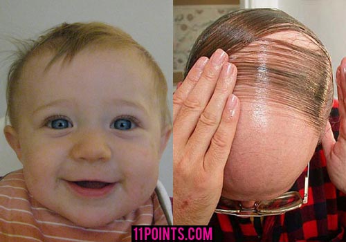combover