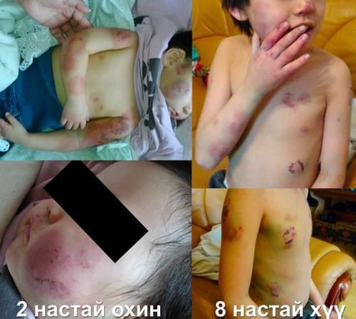 119335720df8ccc9big
