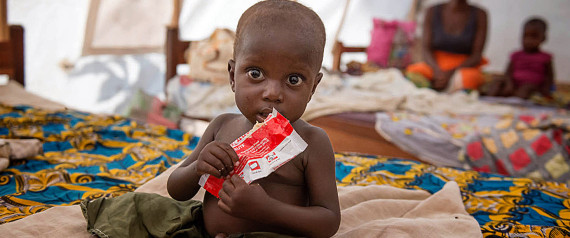 n-CENTRAL-AFRICAN-REPUBLIC-HUNGER-large570 n-CENTRAL-AFRICAN-REPUBLIC-HUNGER-large570